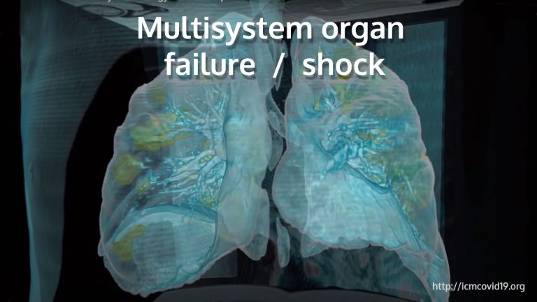 Multi-system organ failure / shock